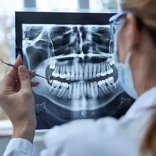 Dental X-RAY